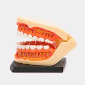 Modelo anatómico: dentadura de adulto x 41 piezas